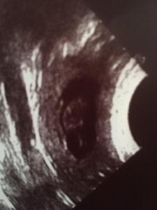 signal-2020-12-01-154747 001