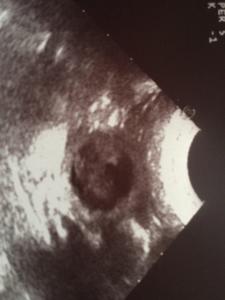 signal-2020-12-01-154747 002